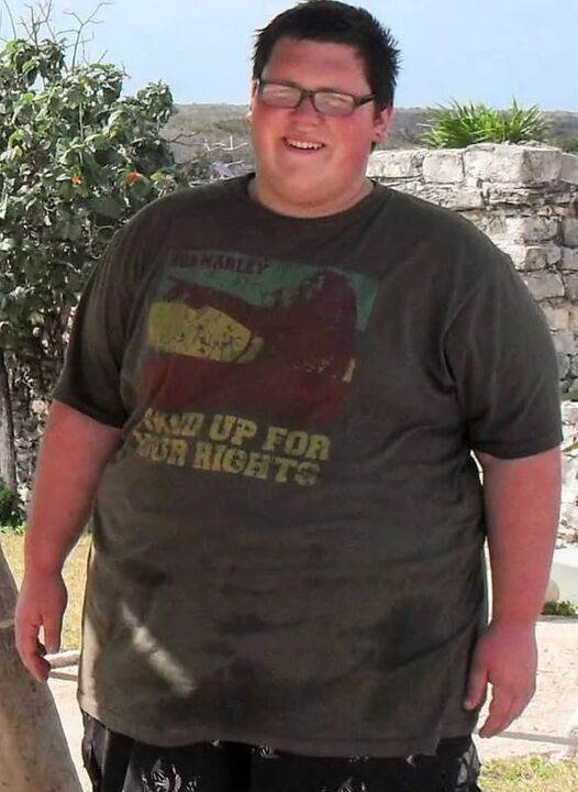 Nadměrná hmotnost před použitím Keto Probiotix